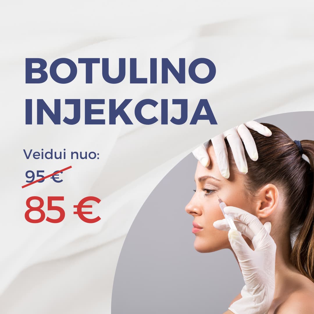 Botulino injekcija