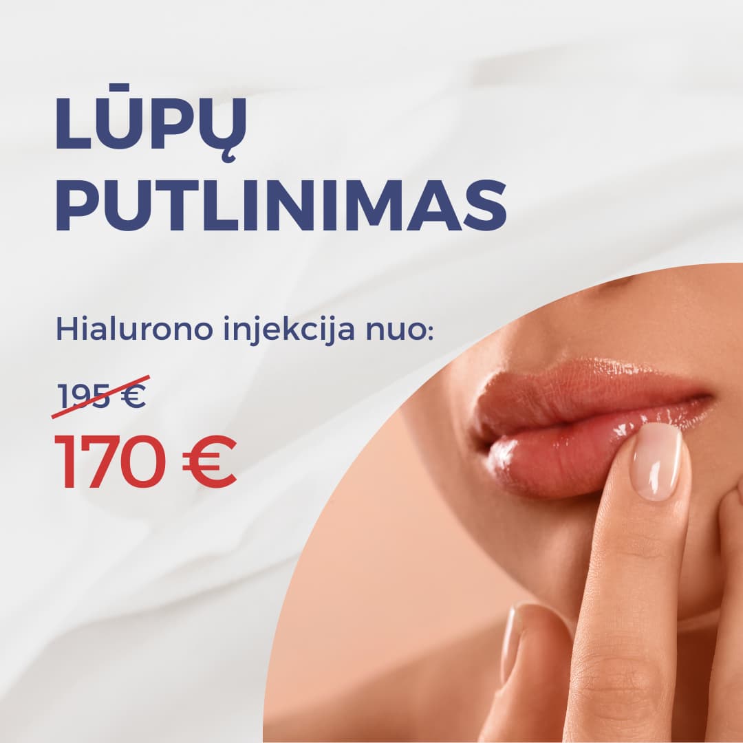 Lūpų putlinimas