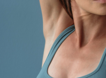Botulinum toxin injections for excessive sweating